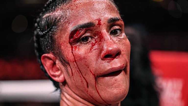 Amanda Serrano: ‘I wear my scars with pride’